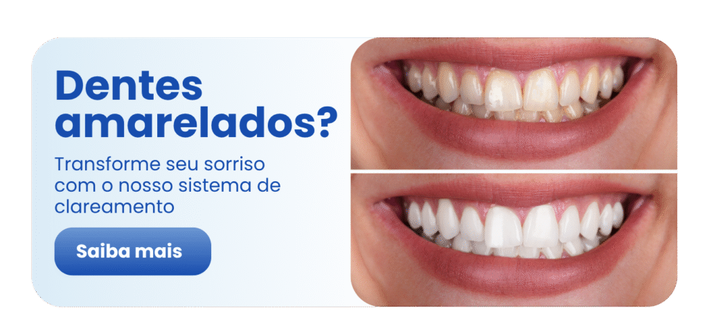 Tratamentos Odontológicos - Dra. Rafaela Queiroz Iturama